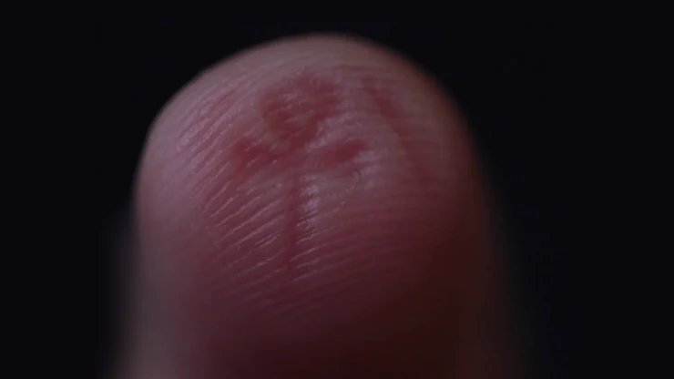 Thumb 5